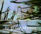 scalp